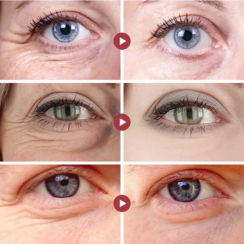 Wrinkle Remove Eyes Patches Fi - Sheet Mask Collagen recension och pris